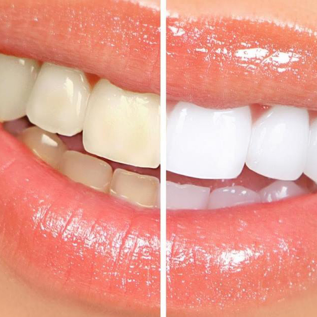 Studio Cruciata | Estetica dentale ad Alcamo