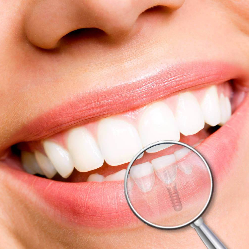 Studio Cruciata | Estetica dentale ad Alcamo