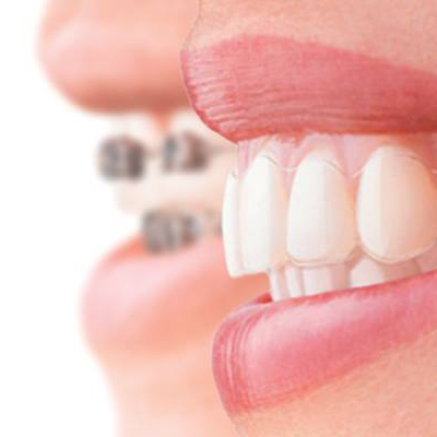 Studio Cruciata | Estetica dentale ad Alcamo